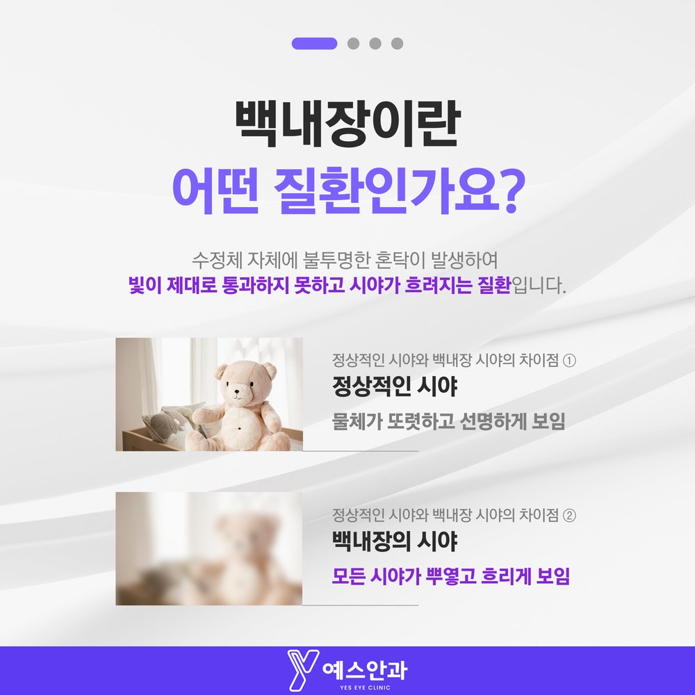 백내장이란 어떤 질환인가요?