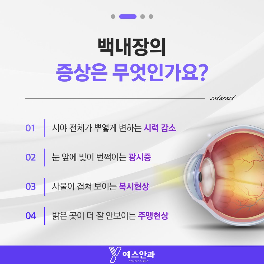 백내장의 증상은 무엇인가요?