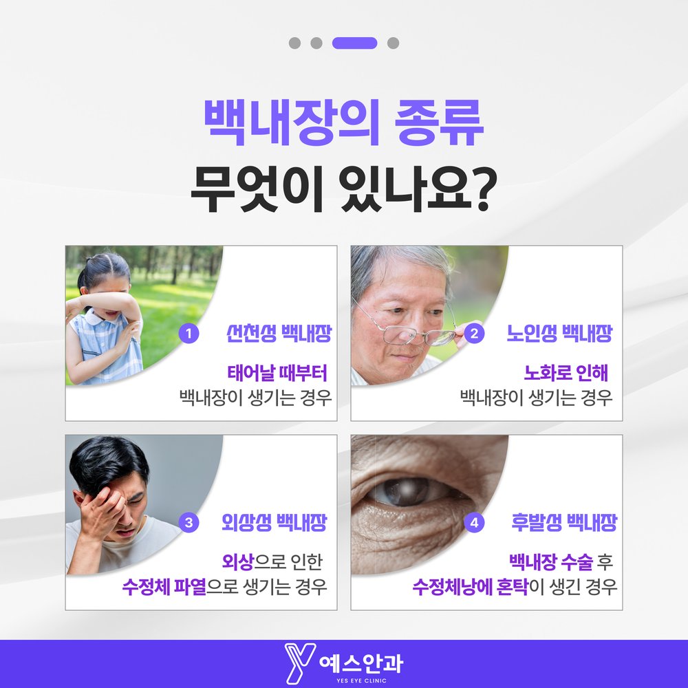 백내장의 종류