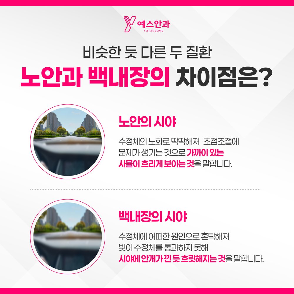 노안과 백내장의 차이점은?