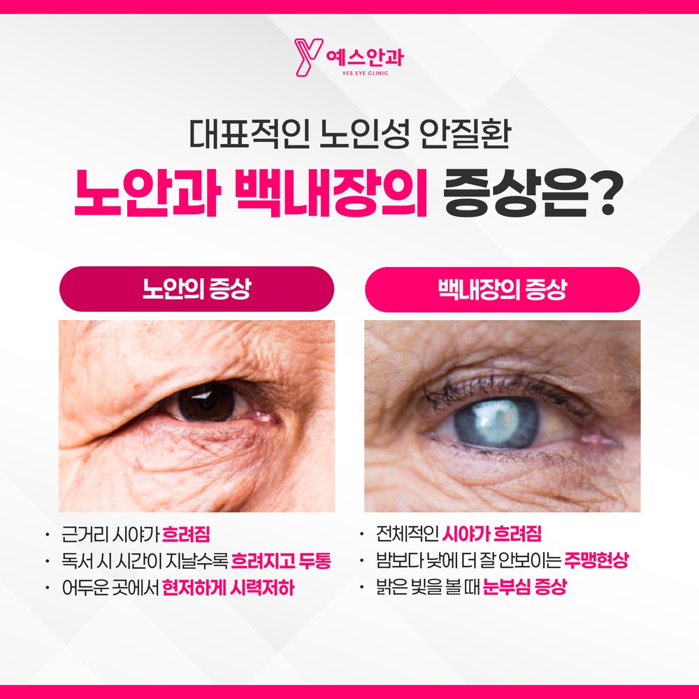노안과 백내장의 증상은?